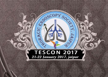 TESCON 2017